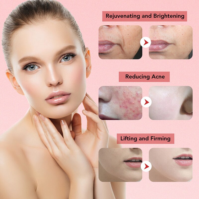 Face Massager Skin Rejuvenation Mesotherapy Facial Lifting